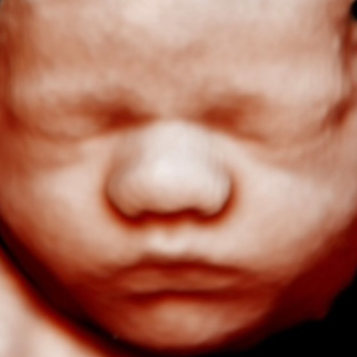 baby bonding ultrasound